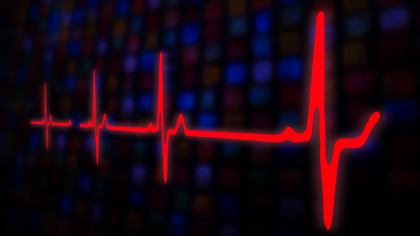 CSD-AFNet : computationally efficient atrial fibrillation classification from ECGs using 2D causal strided dilated convolutions