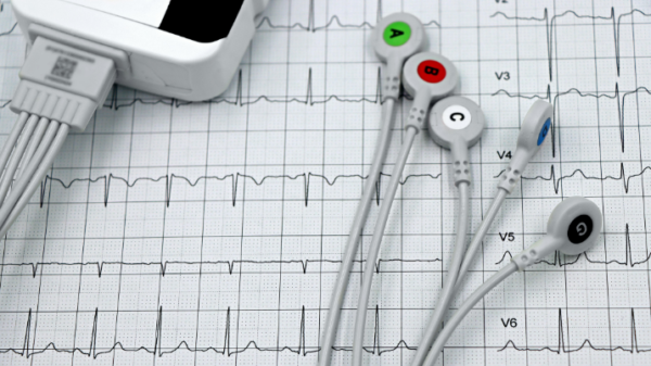 Mid-term benefits and short-term haemodynamic evaluation by kinocardiography of left bundle branch pacing compared with apical ventricular pacing