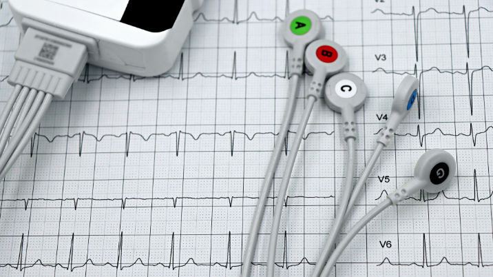 Mid-term benefits and short-term haemodynamic evaluation by kinocardiography of left bundle branch pacing compared with apical ventricular pacing
